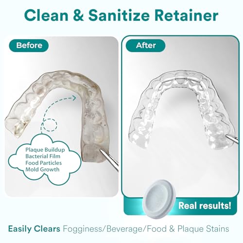 Weiss Naturals Retainer Cleaner Tablets, Invisalign Cleaner, Remove Stains, Odors & Plaque, FSA & HSA Eligible, PERSULFATE FREE Night Guard & Denture Cleaner 4-Month Supply, 120 Mint Scented Tablets