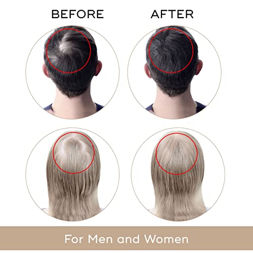 USA Dekohair Hair Regrowth Serum - Stops Hair Thinning, Promotes Growth, Increases Root Volume