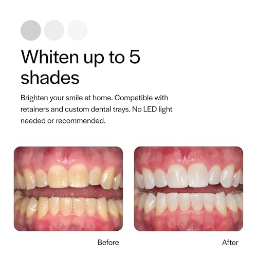 Opalescence 20% Gel Syringes Teeth Whitening - Refill Kit (8 Syringes) Carbamide Peroxide, Fluoride. Made by Ultradent, in Mint Flavor. Tooth Whitening - 5196-4