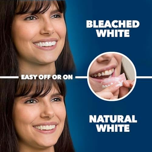 Imako Premium Cosmetic Uppers - 1 Pack - Large, Bleached White - Custom Fit at Home, DIY Smile Makeover, Made in USA