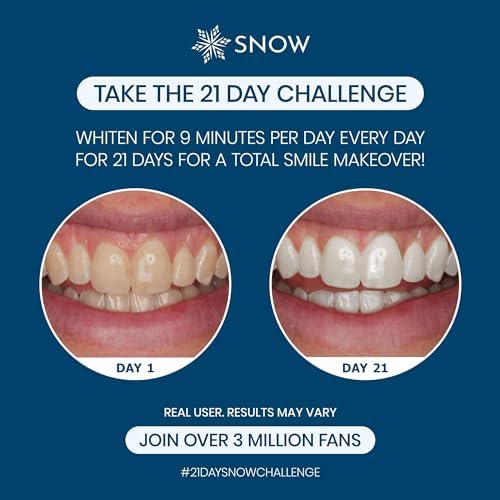Snow Teeth Whitening Kit - Snow Teeth Whitening Serum and LED Mouthpiece Whitener, Formulated with Hydroxyapatite, Good for 6 Months - Wired Kit with 3 Wands