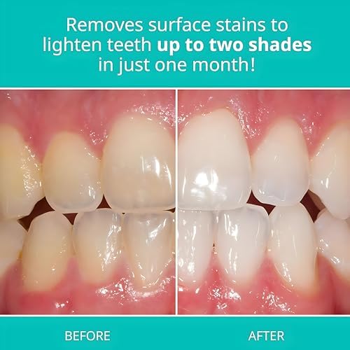 OpalescenceTeeth Whitening Toothpaste - Pack of 1 - Fluoride Oral Care - 4.7 Oz - Cool Mint - TP-5166-1