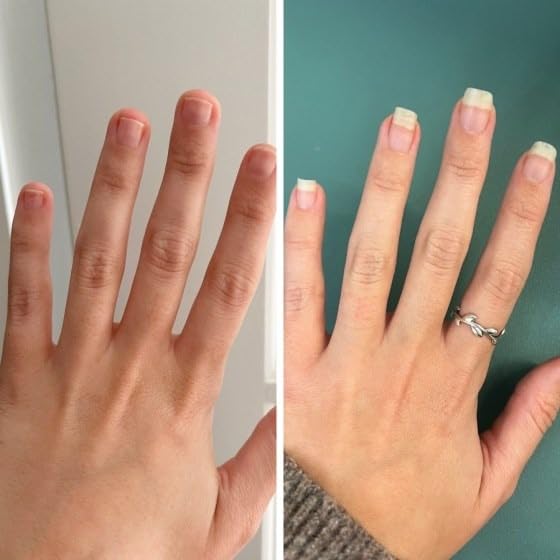 Mavala Mavaderma Nourishing Massage Oil for Nails, Nail Care, Nail Hardener, Cuticle Oil Nail Growth, Moisturizing & Healing Treatment for Cracked Nails & Rigid Cuticles (0.3 Ounce)