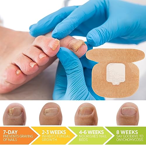 Toenail Fungus Treatment Extra Strength: (Small) 32 Patches with Hydrogel for Overnight Repair Fungus Nail Treatment For Toenail - Nighttime Nail Patches Visible Results in 8 Hours