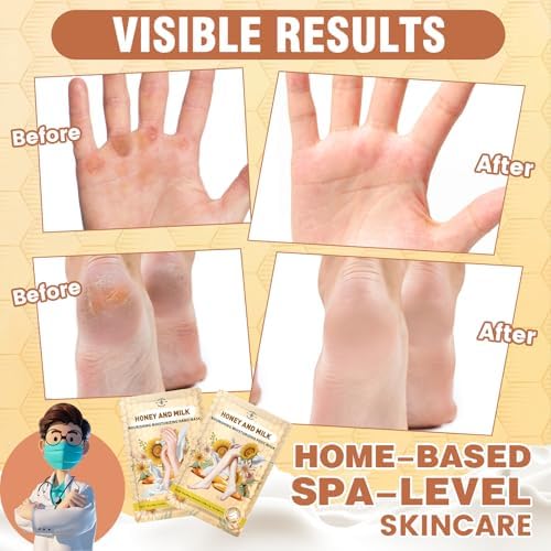 18 Pairs Moisturizing Hand & Foot Masks with Honey, Milk, Vitamin E & Glycerin, Intensely Hydrating Foot Mask For Dry Cracked Feet, Moisturizing Socks for Cracked Heel Treatment