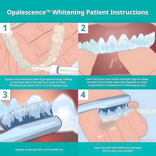 Opalescence 15% Gel Syringes Teeth Whitening Refill Kit - Low Sensivity (2 Packs / 4 Syringes) - Cool Mint - Carbamide Peroxide - Made in The USA by Ultradent Tooth Whitening 5195-2