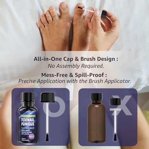Toenail Fungus Treatment Extra Strength, Toe Fungus Treatment for Toenail, Fungus Nail Treatment, Nail Fungus Treatment for Damaged Nail & Athletes Foot (1oz)