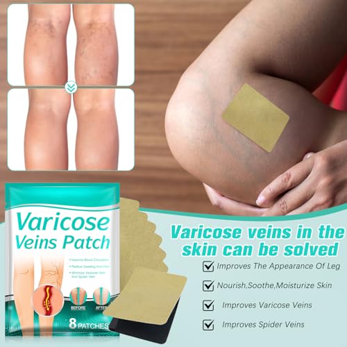 16Pcs LegRenew Varicose Veins Patch, Professional Varicose Veins Patch for Legs, Improves the Appearanceof Leg (2 Packs)