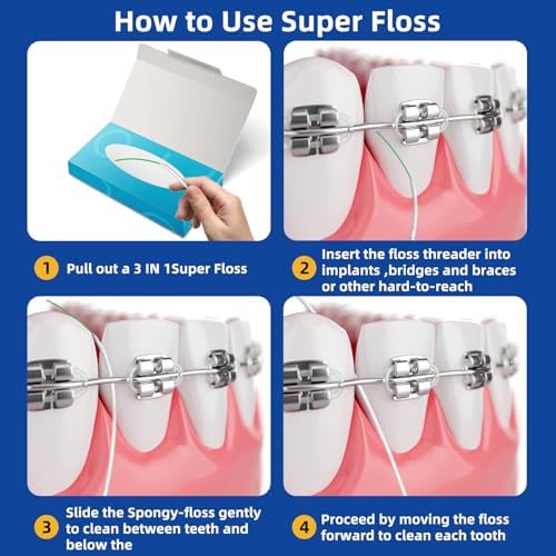 Dental Floss for Braces, Floss Threaders for Bridges and Implants 80 Pre-Cut Strands (Pack of 3)